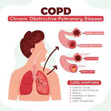 COPD