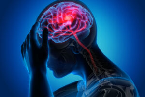 Migraine: Causes, Treatments, and Lifestyle Changes for Effective Relief