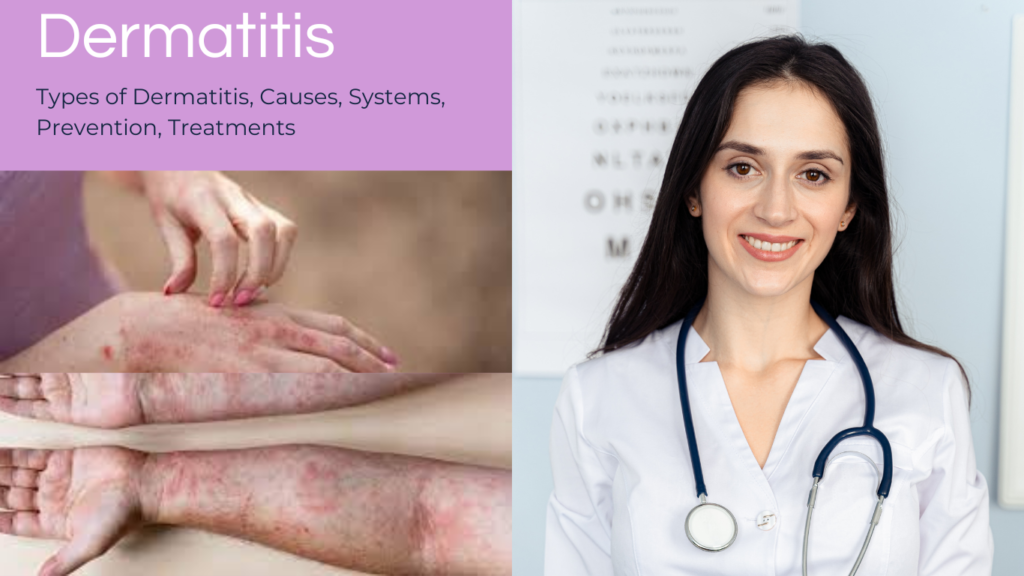 Dermatitis